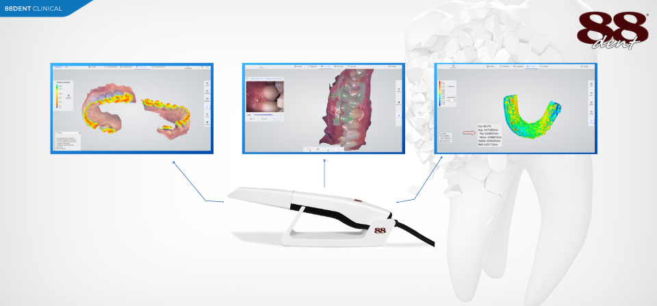 How does the intraoral scanner work? 10issues you haven't asked yourself